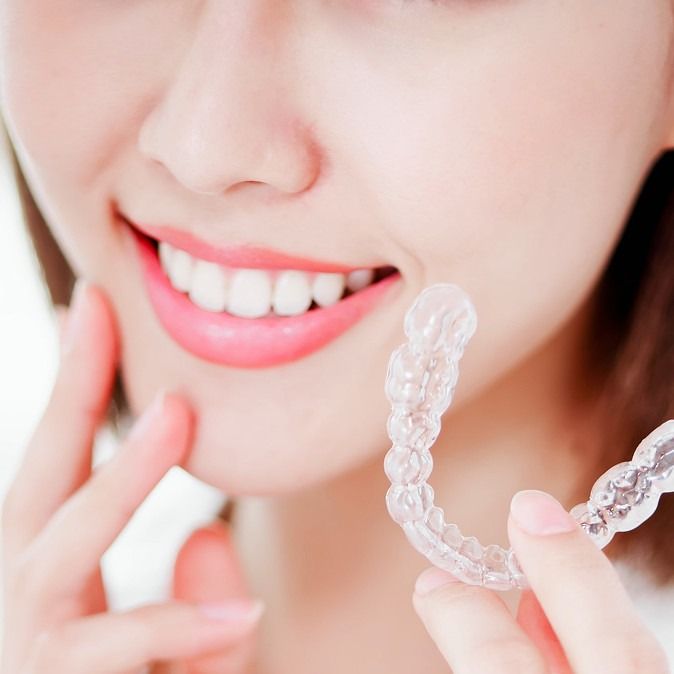 Niềng Răng Hà Nội Ở Đâu Tốt? Bảng Giá & Kinh Nghiệm Mới Nhất 2026